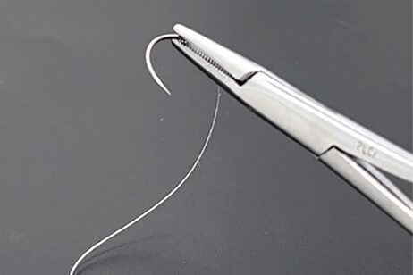 Il filo utilizzato per realizzare suture in grado di stimolare elettricamente le ferite (fonte: Zhouquan Sun e Chengyi Hou)