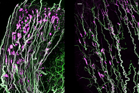 le cellule nervose sensoriali chiamate corpuscoli di Krause sono più dense sul clitoride dei topi femmine (a sinistra) che sul pene dei topi maschi (a destra). Crediti: Lijun Qi, Michael Iskols e David Ginty