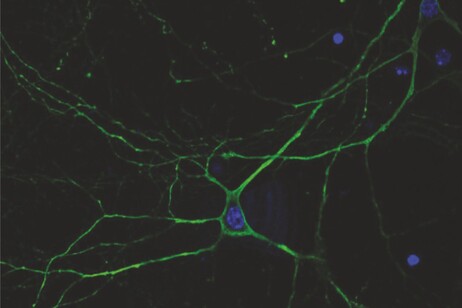 Neurone trattato con la nuova strategia terapeutica (fonte: Istituto Italiano di Tecnologia - © IIT)