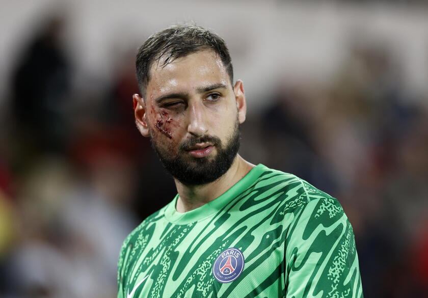 Goleiro ficou com o rosto ensanguentado