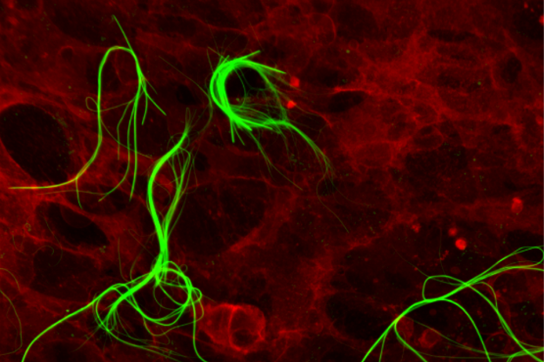 Nanostructures are growing inside a human cell (credit: CNR, IIT) - RIPRODUZIONE RISERVATA