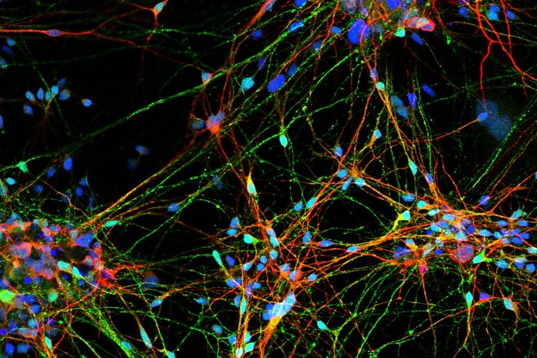 Neuroni (fonte: Dr. Matteo Cereda, Università degli Studi di Milano) - RIPRODUZIONE RISERVATA